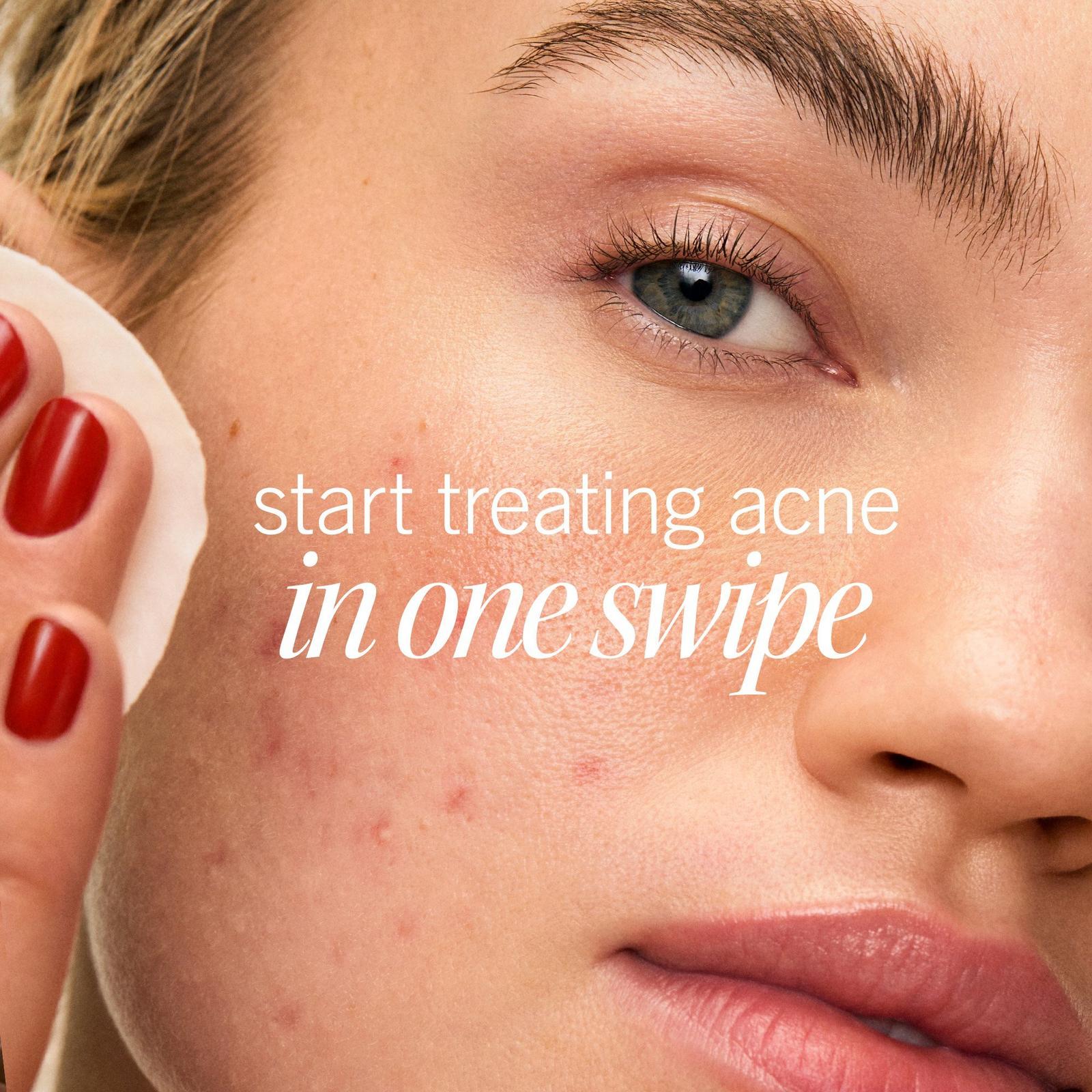 Acne Clearing Pads 2% Salicylic Acid Acne Treatment