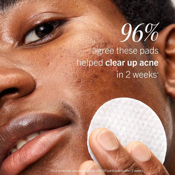 First Aid Beauty Acne Clearing Pads 2% Salicylic Acid Acne Treatment #7