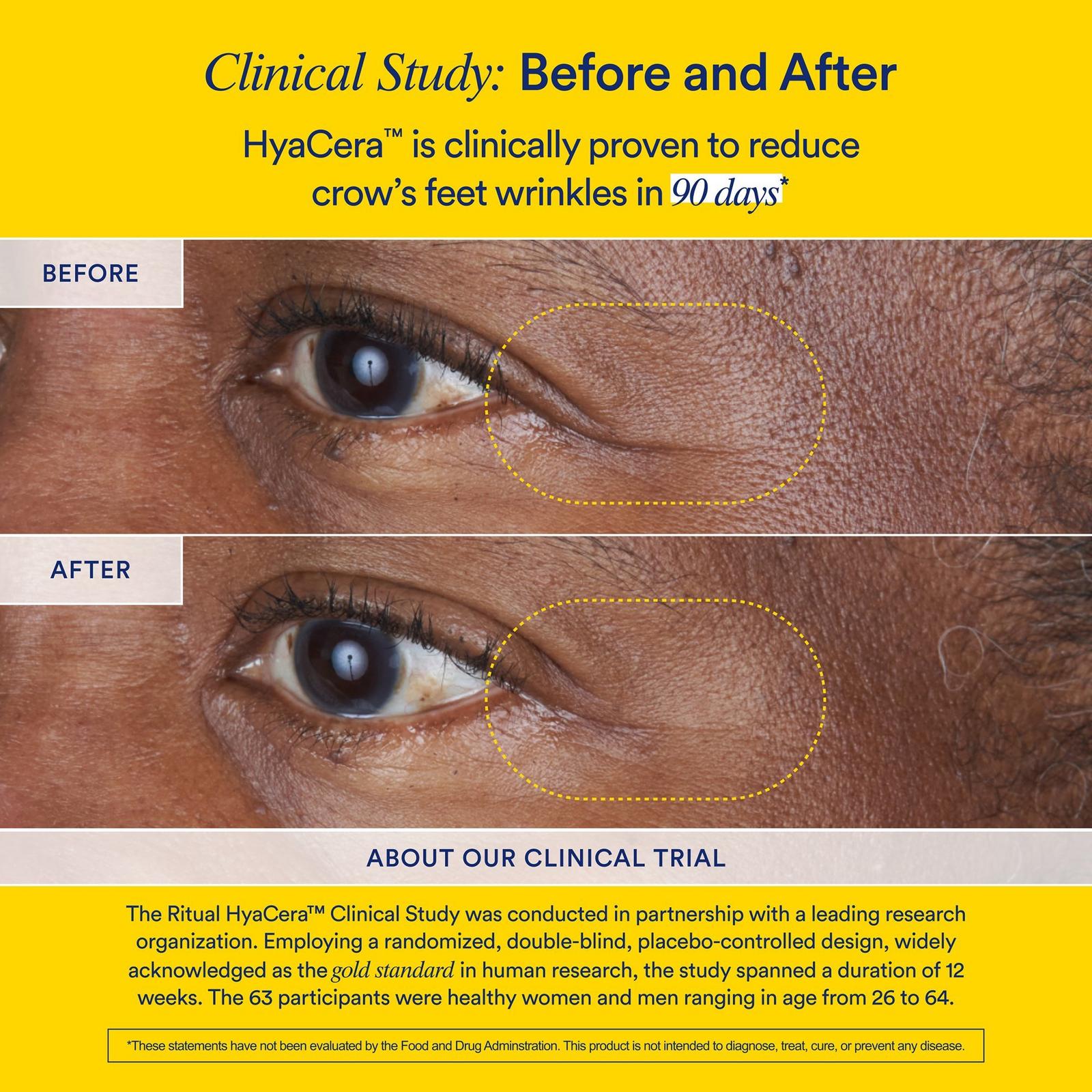 HyaCera Skin Supplement for Wrinkle Support