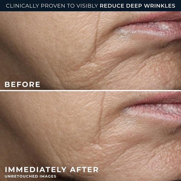 RoC Deep Wrinkle Rich Cream #5
