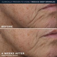 RoC Deep Wrinkle Rich Cream Moisturizer #6