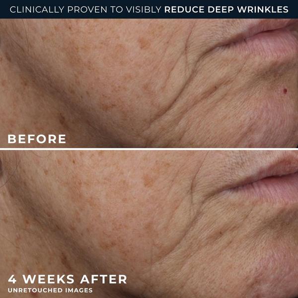 RoC Deep Wrinkle Rich Cream #6
