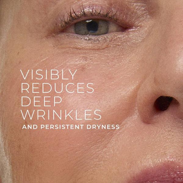 RoC Deep Wrinkle Rich Cream #7