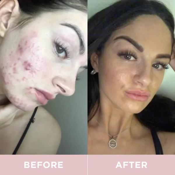 Revive Collagen Original Liquid Collagen Drink #7