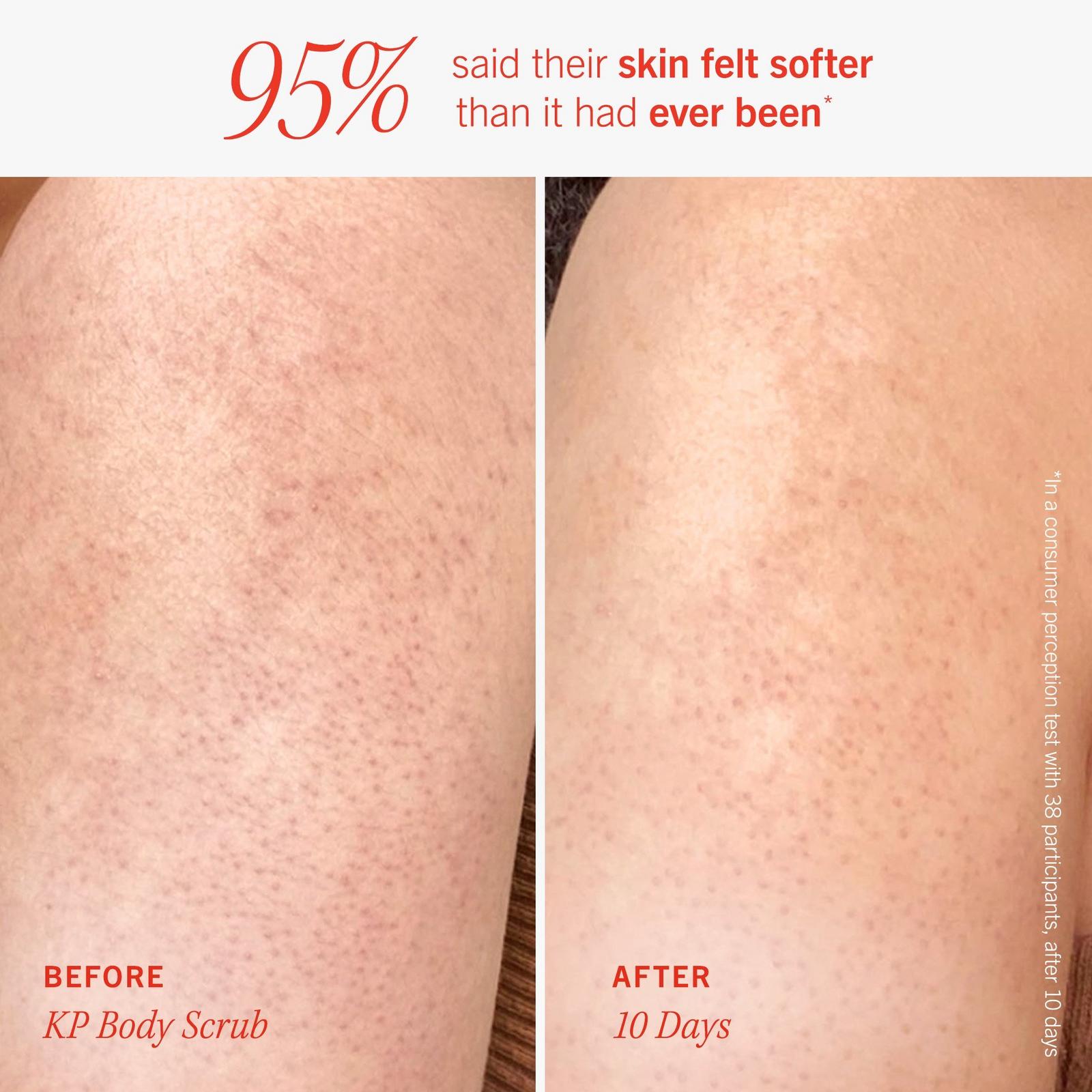 Soft + Smooth Starter Kit - Body Bestsellers