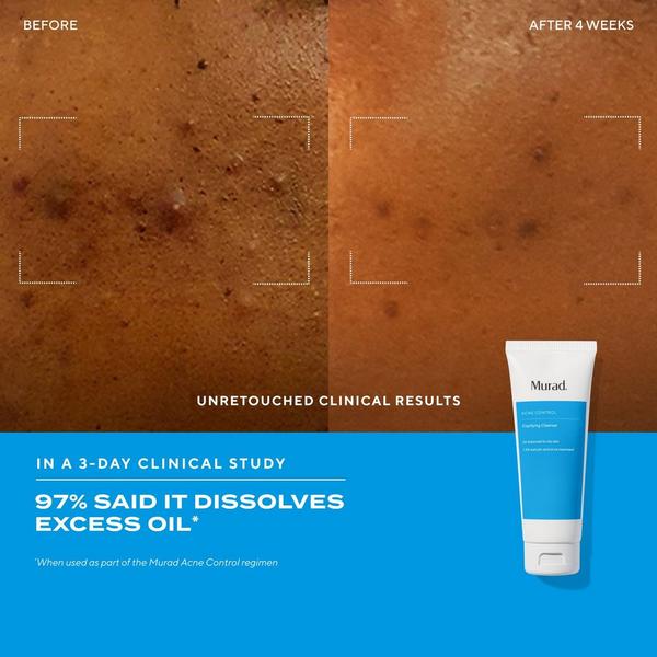 Murad Clarifying Gel Cleanser with Salicylic Acid #4