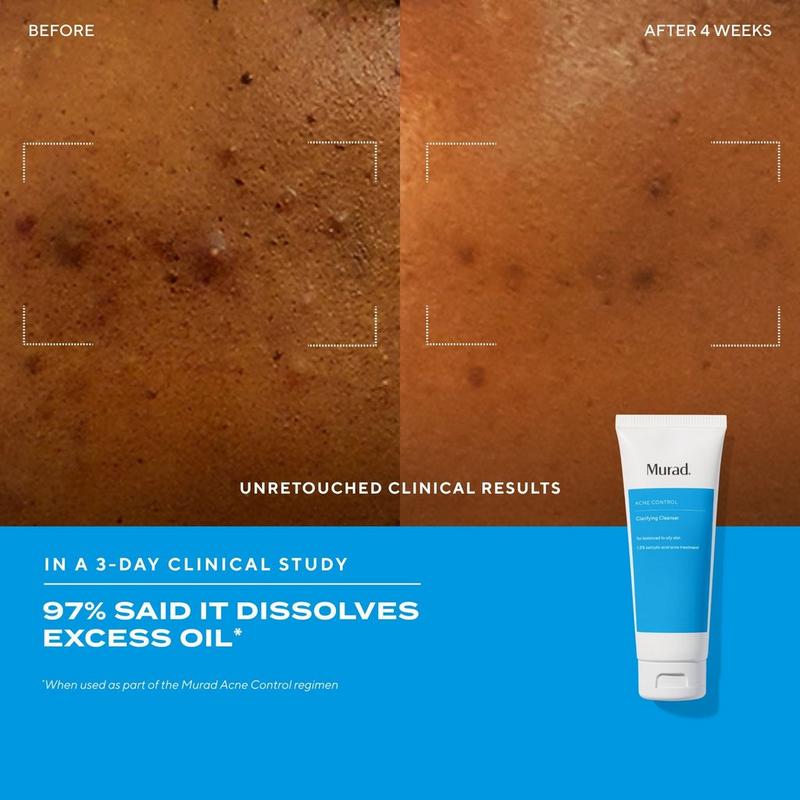 Murad Clarifying Gel Cleanser with Salicylic Acid #4
