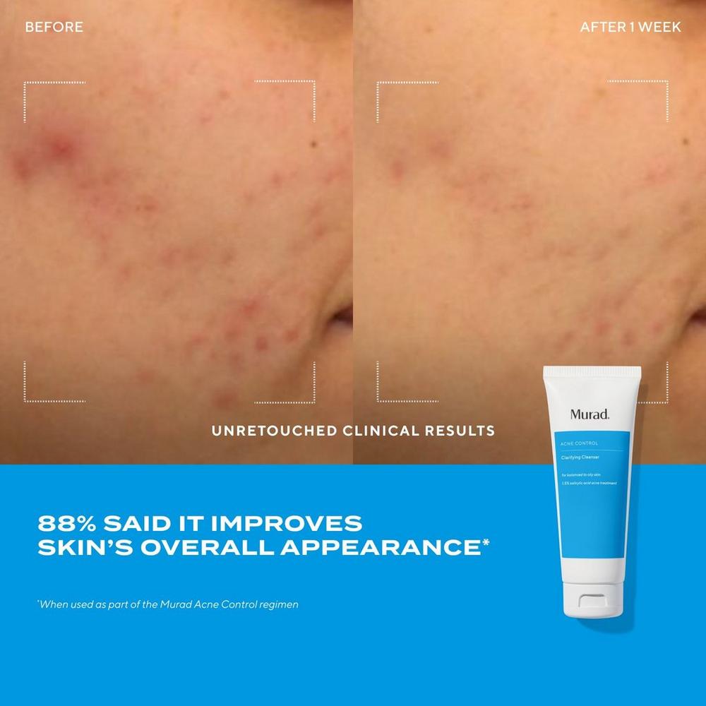 Clarifying Gel Cleanser with Salicylic Acid