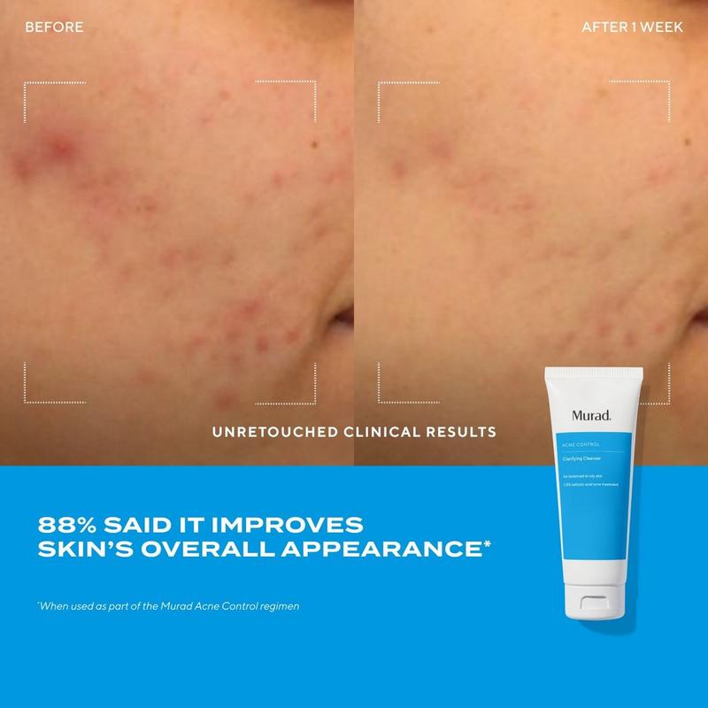 Murad Clarifying Gel Cleanser with Salicylic Acid #5