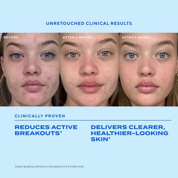 Murad Biome-Balancing Clear & Prevent Acne Treatment Serum #3