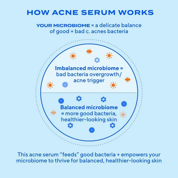 Murad Biome-Balancing Clear & Prevent Acne Treatment Serum #5