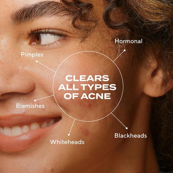 Murad Biome-Balancing Clear & Prevent Acne Treatment Serum #6