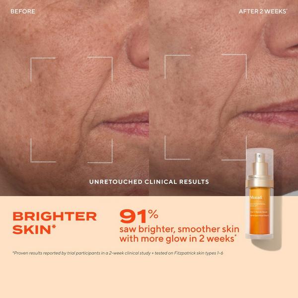 Murad Glow Better Brightening Starter Kit #5