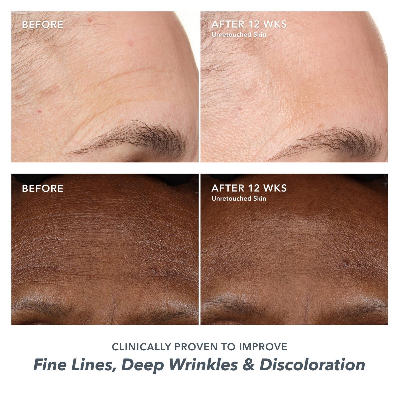 Milk RX Advanced Better Aging Wrinkle Serum