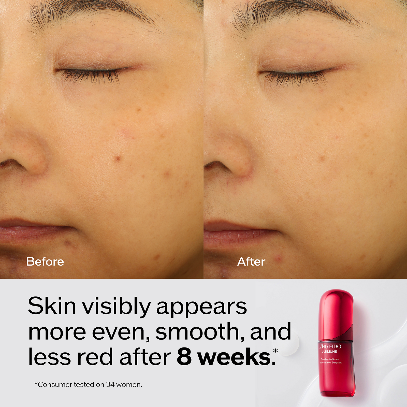 Ultimune Power Infusing Serum - 1.0 oz