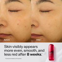 Shiseido Ultimune Power Infusing Serum #4