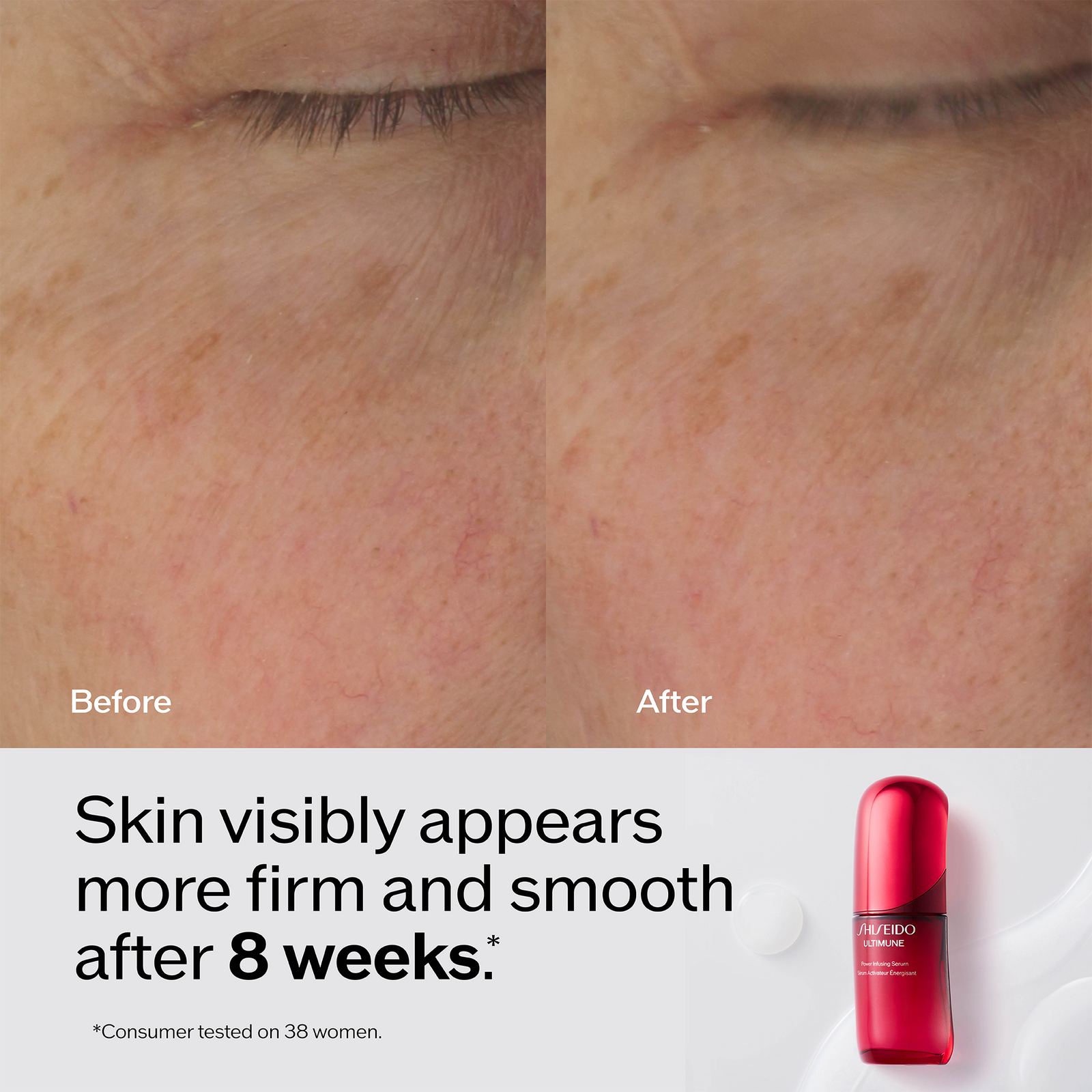 Ultimune Power Infusing Serum - 1.0 oz