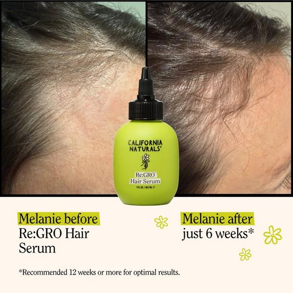 California Naturals Re:GRO Hair Serum #5