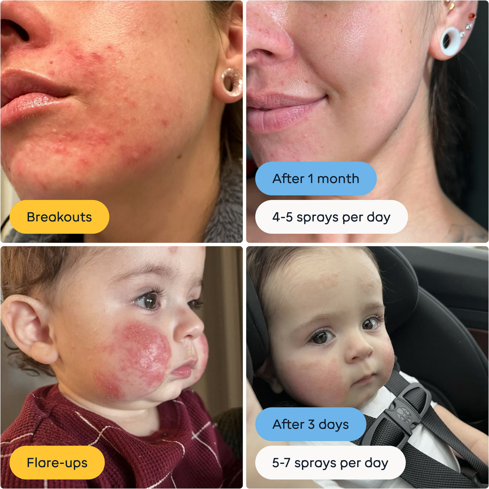 Travel Size Hypochlorous Acid Spray