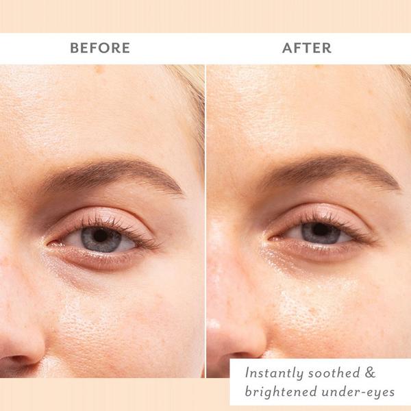 Patchology Skin Remedy Soothing Eye Gels #4