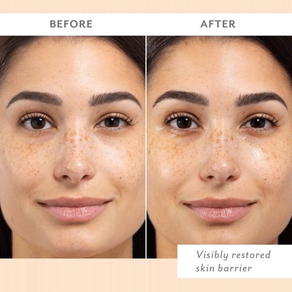 Patchology Skin Remedy Barrier-Boosting Sheet Mask #4