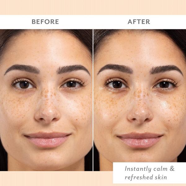Patchology Skin Remedy Calm & Protect Mist #4