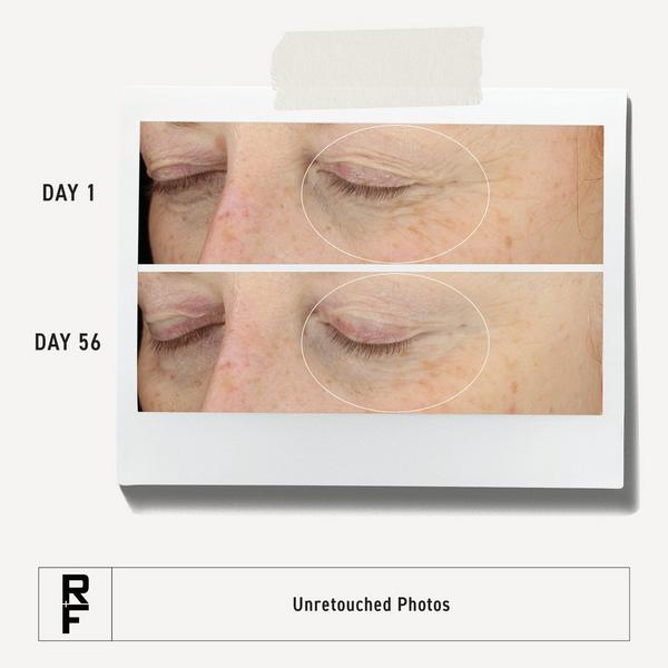 RODAN + FIELDS Redefine Multi-Function Eye Cream for Undereye Wrinkles + Crow's Feet #6