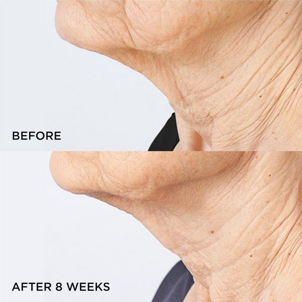 Perricone MD Cold Plasma Plus+ Sub-D Neck Duo #3