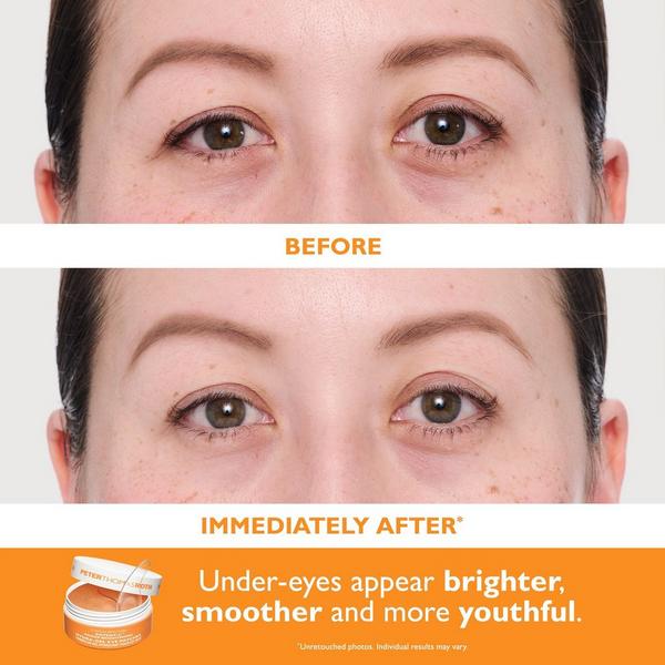 Peter Thomas Roth Full-Size Vitamin C & Hyaluronic Eye Patches 2-Piece Kit #3