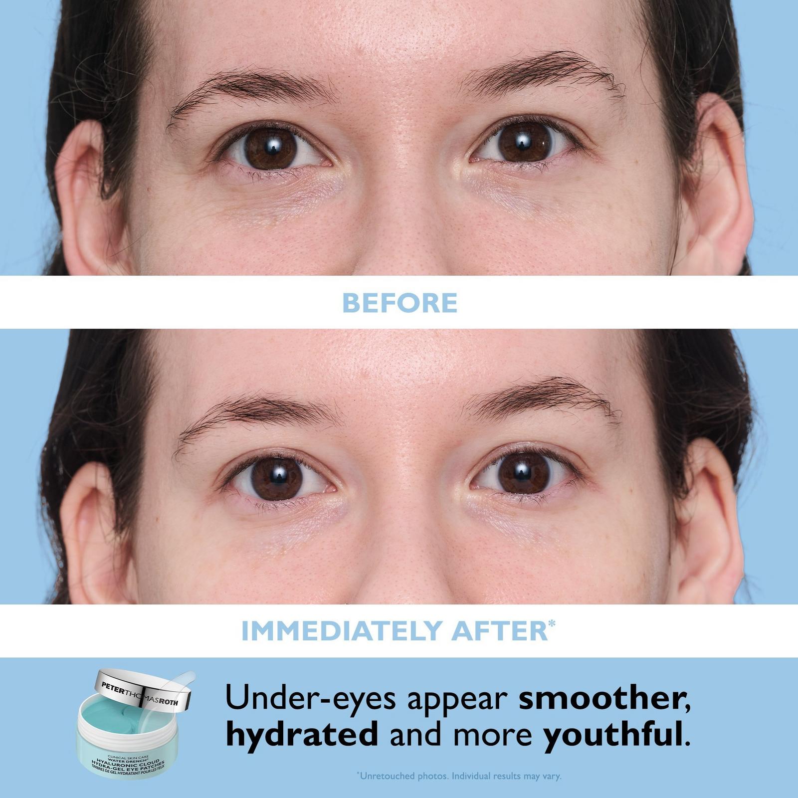 Full-Size Vitamin C & Hyaluronic Eye Patches 2-Piece Kit