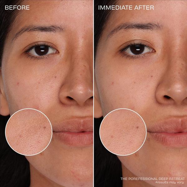 Benefit Cosmetics Connect Pore 4-Piece Skincare Gift Set #4