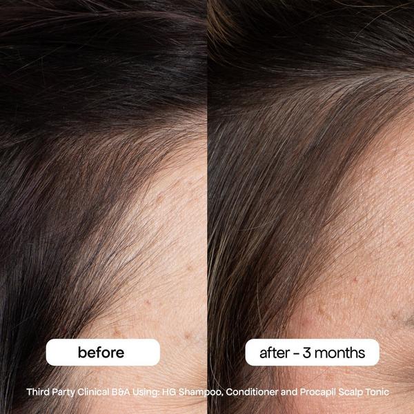 Bondi Boost Travel Size HG Anti Thinning Conditioner #4