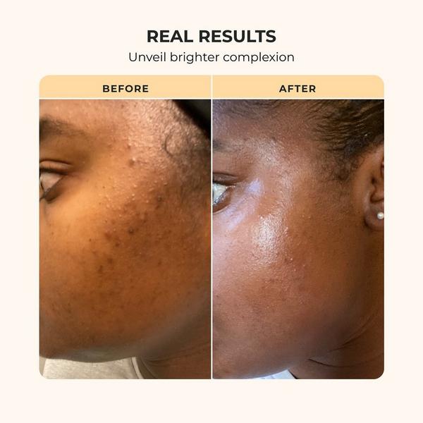 Buttah Skin 3 Piece Skin Transforming Set #4