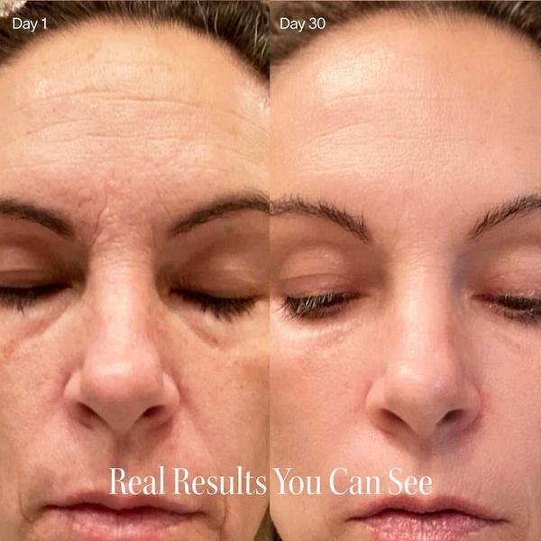 Solawave Red Light Skincare Ritual Kit #4