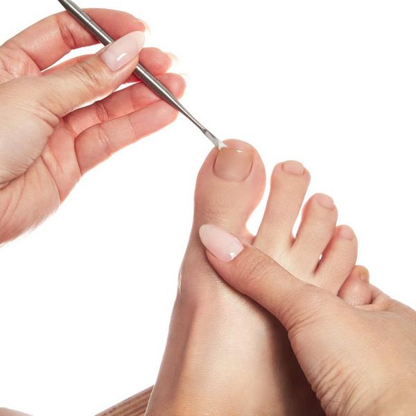 Flowery Pro Ingrown Toenail Lifter Tool #3
