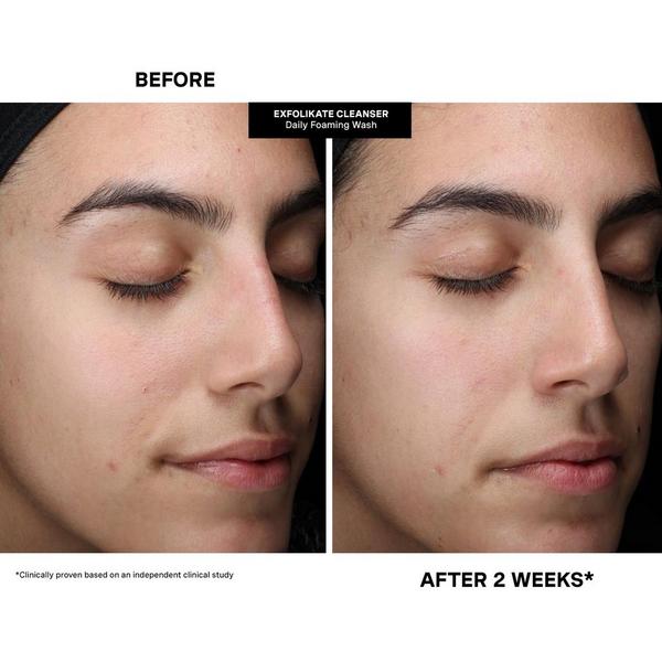 Kate Somerville Pore-fect Skin Edit Travel Kit #7