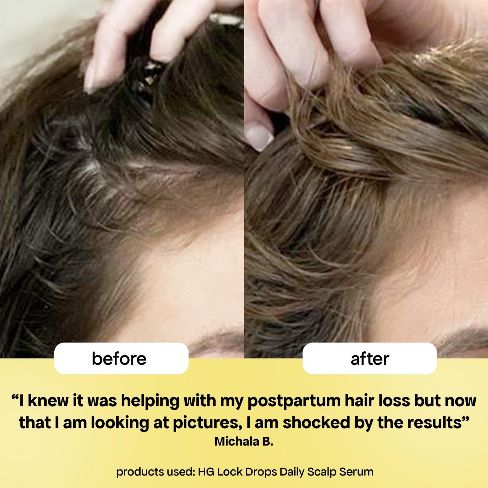 HG Lock Drops Scalp Serum for Thinning Hair - 1.0 oz
