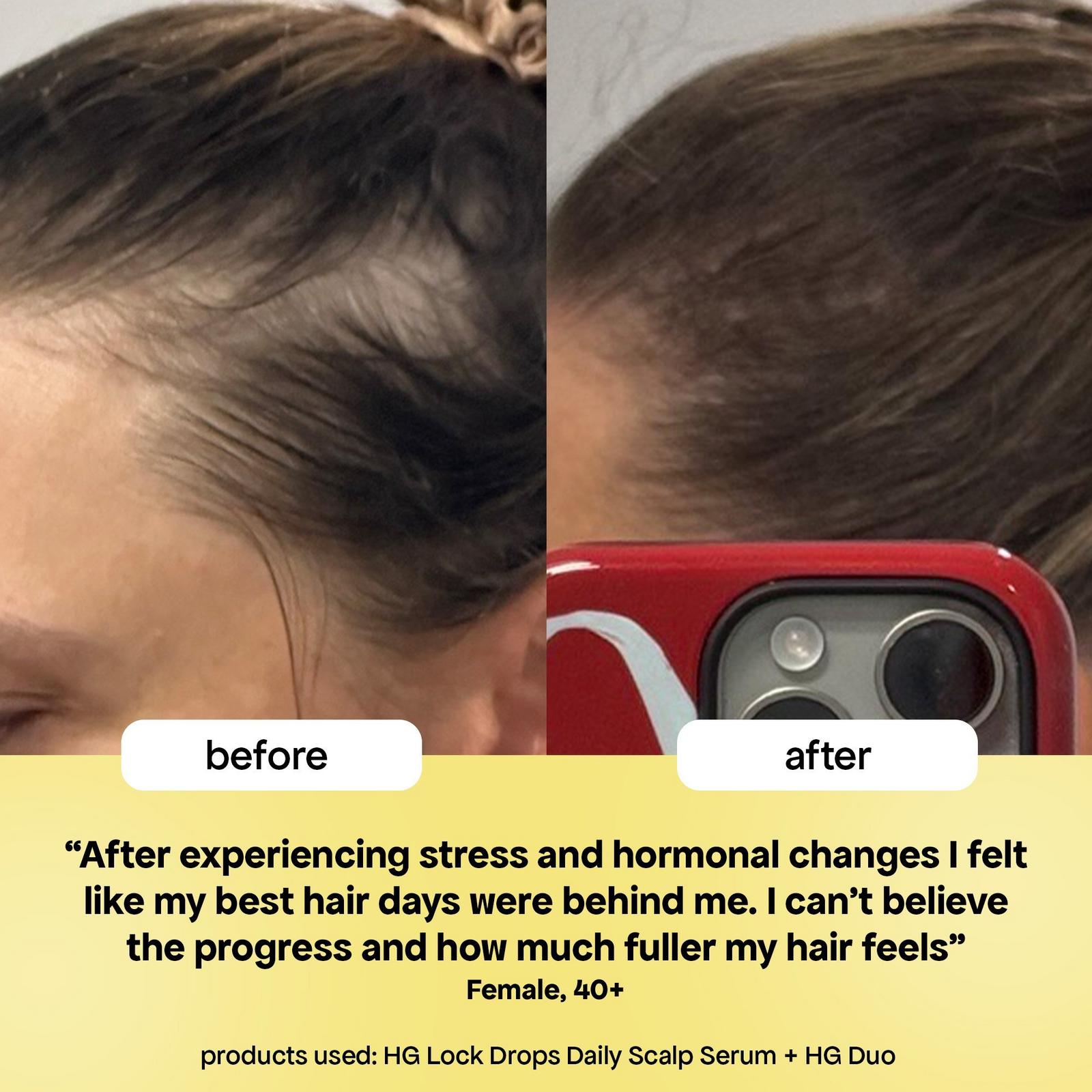 HG Lock Drops Scalp Serum for Thinning Hair - 1.0 oz