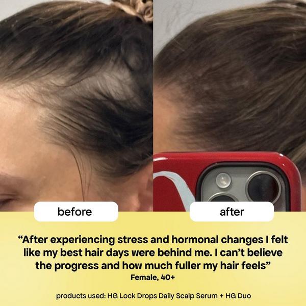 Bondi Boost HG Lock Drops Scalp Serum for Thinning Hair #4