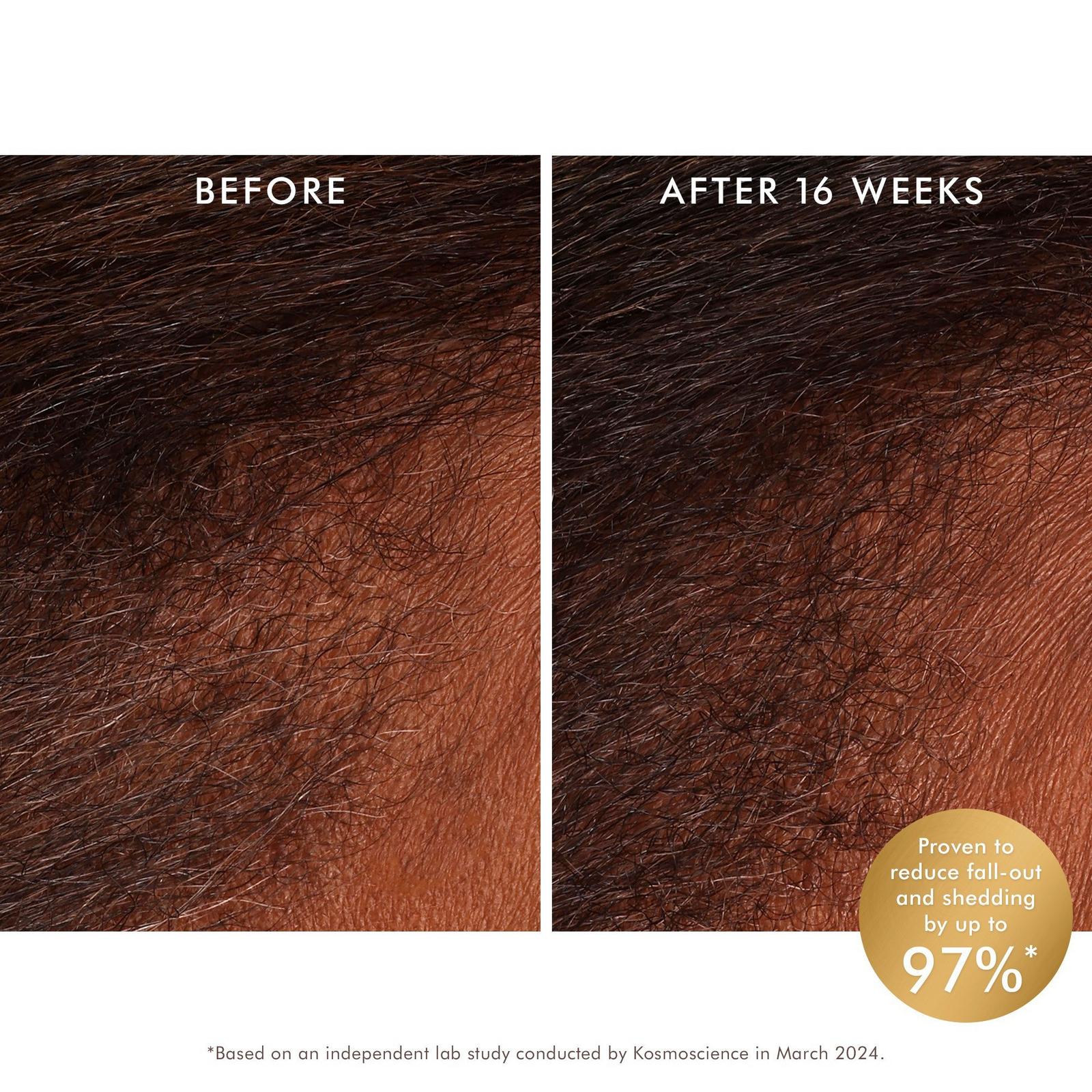 Revitalizing Scalp Tonic