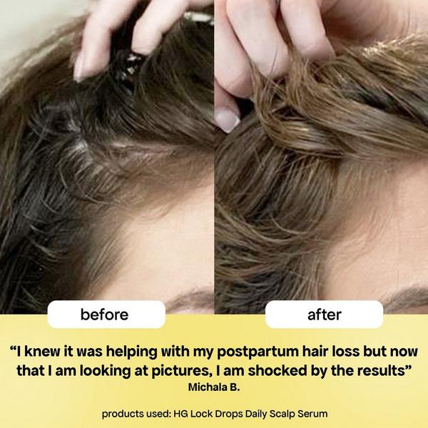 Bondi Boost HG Lock Drops Scalp Serum for Thinning Hair #3