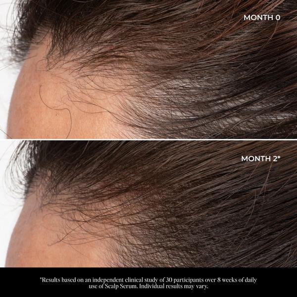 LolaVie Let There Be Hair Scalp Serum #8