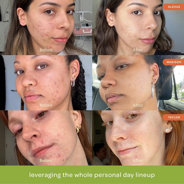 Personal Day Dive Deep Mevalonic Moisturizer #6