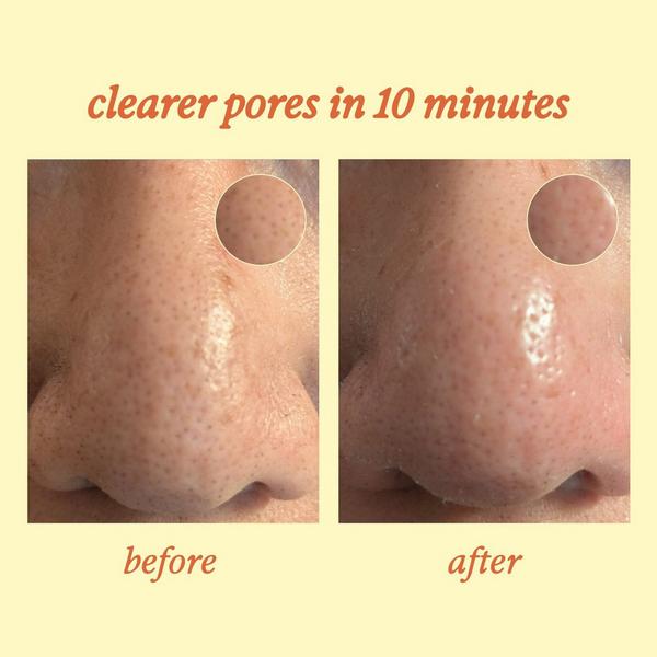 Personal Day Unplug Blackhead-Melting Nose Strips #7