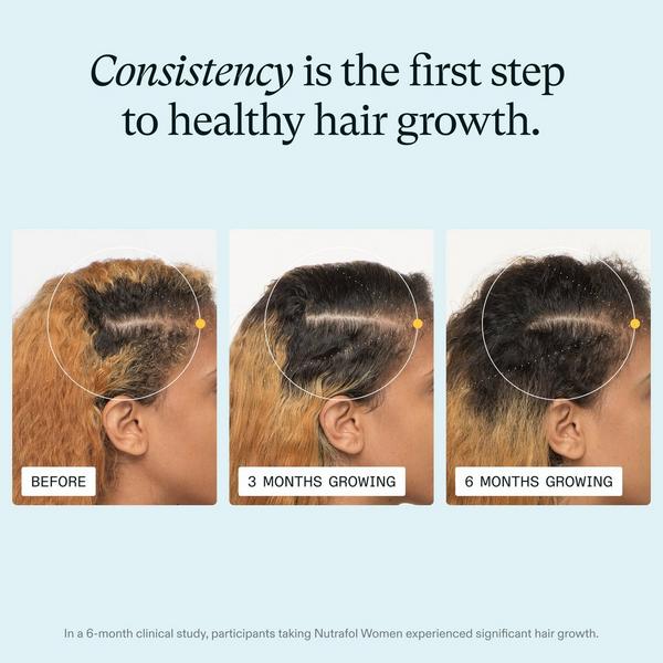 NUTRAFOL Women Clinically Proven Hair Growth Supplement #3
