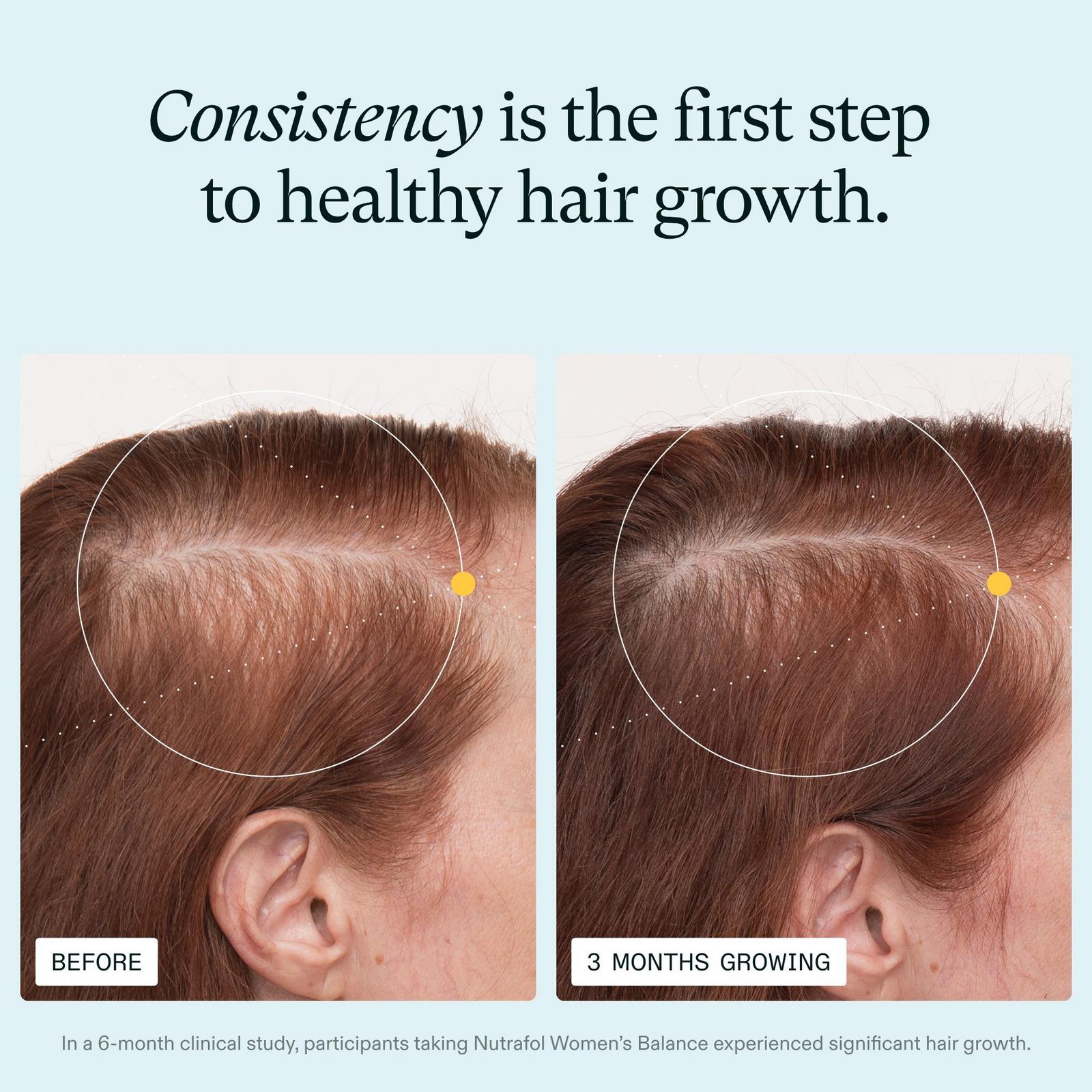 Women's Balance 45+ Clinically Proven Hair Growth Supplement