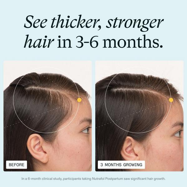 NUTRAFOL Postpartum OBGYN-Formulated Hair Growth Supplement #2
