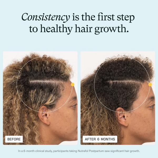 NUTRAFOL Postpartum OBGYN-Formulated Hair Growth Supplement #3