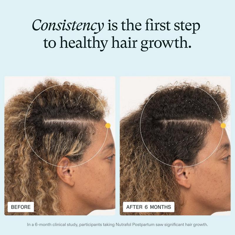 glutathione for hair growth before and after thinning stealing your confidence?  It's time to nourish your hair from within with Hair Treatment at Cabelo Clinic   Strengthens Hair Roots  Promotes Healthy Hair  Does glutathione help in hair