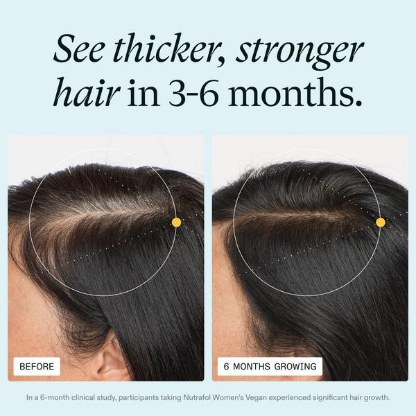 NUTRAFOL Women's Vegan 18-44 Clinically Tested Hair Growth Supplement #2